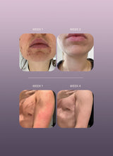 The Skin Pearls Face Oil